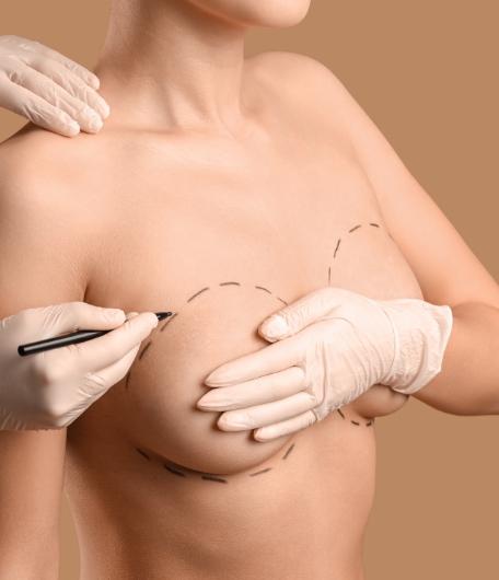 Markierungen an der Brust vor Plastischer Operation