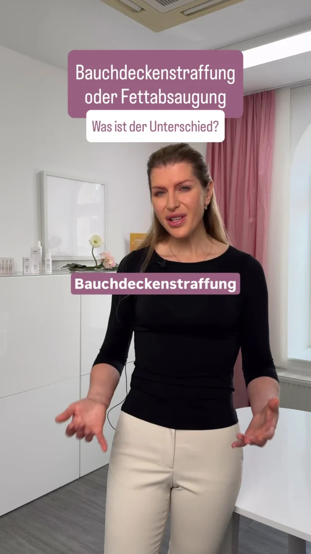 Bauchdeckenstraffung oder Fettabsaugung – das sind zwei völlig unterschiedliche Eingriffe 🤍

Bei einer Fettabsaugung werden die Fettzellen abgesaugt, dadurch wird die Fettschicht dünner. Im Gewebe entstehen anschließend Reparatur- und Heilungsprozesse, die dazu führen können, dass sich die inneren Schichten mit der Zeit wieder aneinanderlegen. Dadurch wirkt die Haut später oft etwas straffer.

Bei einer Bauchdeckenstraffung ist die Situation anders. Hier kann der gesamte überschüssige Haut- und Fettlappen des Bauches entfernt werden. Würde man diesen Hautfettlappen nur absaugen, ohne überschüssige Haut zu entfernen, würde die Haut in vielen Fällen eher noch stärker hängen.

Bei einer klassischen Bauchdeckenstraffung wird der Hautfettlappen zunächst von innen bis zu beiden Rippenbögen abgelöst. Danach wird sehr genau bestimmt, wie viel Gewebe entfernt werden darf, damit am Ende ein spannungsfreier Verschluss möglich ist. Das ist ein entscheidender Punkt für eine gute Wundheilung. Anschließend wird der Bauchnabel wieder an seiner anatomisch richtigen Position eingesetzt.

Deshalb gilt: Fettabsaugung reduziert Fett – Bauchdeckenstraffung entfernt überschüssige Haut und formt die gesamte Bauchdecke neu.

📌 Speichere dir den Beitrag gerne ab, wenn du den Unterschied zwischen Fettabsaugung und Bauchdeckenstraffung besser verstehen möchtest.

#SchlossparkKlinik #Bauchdeckenstraffung