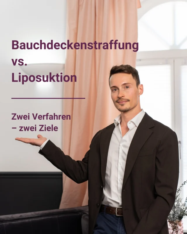 Viele Patientinnen und Patienten kommen mit dem Wunsch nach einem flacheren und strafferen Bauch zu uns – und fragen sich: Reicht eine Liposuktion oder brauche ich eine Bauchdeckenstraffung? ✨

Die wichtigste Antwort vorweg: Beides sind unterschiedliche Eingriffe mit unterschiedlichen Zielen.

Bei einer Liposuktion wird überschüssiges Fett entfernt. Sie eignet sich besonders für Menschen, die trotz Sport und gesunder Ernährung unter hartnäckigen Fettdepots leiden – zum Beispiel am Unterbauch, an den Flanken oder an der Taille. Voraussetzung ist, dass die Haut noch genügend Elastizität besitzt und sich nach der Fettentfernung gut zurückziehen kann.

Eine Bauchdeckenstraffung (Abdominoplastik) verfolgt ein anderes Ziel: Sie entfernt überschüssige Haut, strafft die Bauchdecke und kann bei Bedarf auch auseinandergewichene Bauchmuskeln stabilisieren. Das ist häufig nach Schwangerschaften oder nach einer deutlichen Gewichtsabnahme sinnvoll, wenn die Haut nicht mehr von allein straff wird.

Ein häufiger Irrtum ist, dass eine Fettabsaugung hängende Haut beseitigen kann. Ist bereits ein deutlicher Hautüberschuss vorhanden, kann die Liposuktion die Erschlaffung sogar sichtbarer machen. Umgekehrt entfernt eine Bauchdeckenstraffung zwar Haut, ersetzt aber nicht automatisch die gezielte Konturierung durch eine Fettabsaugung.

Deshalb kombinieren wir in bestimmten Fällen beide Verfahren: 🔹Liposuktion zur Formung der Silhouette 🔹 Bauchdeckenstraffung zur Straffung der Haut

Welche Methode für Sie geeignet ist, lässt sich nur nach einer individuellen Untersuchung beurteilen. Entscheidend sind: • die Hautelastizität • die Menge und Verteilung des Fettgewebes • die Bauchmuskulatur • frühere Schwangerschaften oder Gewichtsveränderungen • Ihre persönlichen Wünsche und Erwartungen

Unser Ziel ist nicht ein „Standardbauch“, sondern ein Ergebnis, das natürlich wirkt, zu Ihrem Körper passt und langfristig überzeugt 🤍

Melde dich gerne bei weiteren Fragen: info@schlosspark-klinik.com oder schreib uns eine Message hier auf Instagram.

#SchlossparkKlinik #Bauchdeckenstraffung
