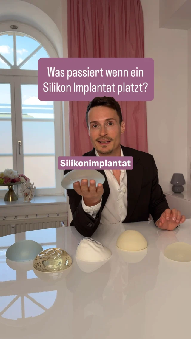 "Was mache ich, wenn mein Implantat geplatzt ist?" – eine Frage, die viele verunsichert. Wir möchten dir hierzu ein paar sachliche Informationen mit an die Hand geben. 🩺

Zunächst: Eine Implantatruptur ist kein Notfall im klassischen Sinne, sollte aber zeitnah ärztlich abgeklärt werden. Man unterscheidet grundsätzlich zwischen zwei Formen: Bei einer symptomatischen Ruptur treten spürbare Veränderungen auf, etwa eine veränderte Form oder Größe, Schwellungen, ein Spannungsgefühl oder Schmerzen. Bei einer stillen ("silent") Ruptur hingegen zeigen sich äußerlich zunächst keine Anzeichen – sie wird oft erst im Rahmen einer Kontrolluntersuchung entdeckt.

Genau deshalb sind regelmäßige Kontrolltermine so wichtig, auch wenn keine Beschwerden vorliegen. Zur sicheren Abklärung wird in der Regel eine bildgebende Untersuchung wie ein Ultraschall oder ein MRT durchgeführt.

Solltest du den Verdacht haben, dass dein Implantat beschädigt sein könnte: Bleib ruhig, beobachte dich nicht "auf eigene Faust" über Wochen, sondern vereinbare zeitnah einen Termin zur Abklärung. Je nach Befund und individueller Situation wird gemeinsam mit dir besprochen, ob und welche weiteren Schritte – etwa ein Implantataustausch – sinnvoll sind.

Wichtig: Diese Informationen ersetzen keine ärztliche Untersuchung. Bei Unsicherheit gilt immer: lieber einmal zu viel nachfragen als zu wenig.

📩 Du hast einen konkreten Verdacht oder Fragen dazu? Melde dich gerne bei uns – wir nehmen uns Zeit für eine ausführliche Abklärung.

#schlossparkklinik