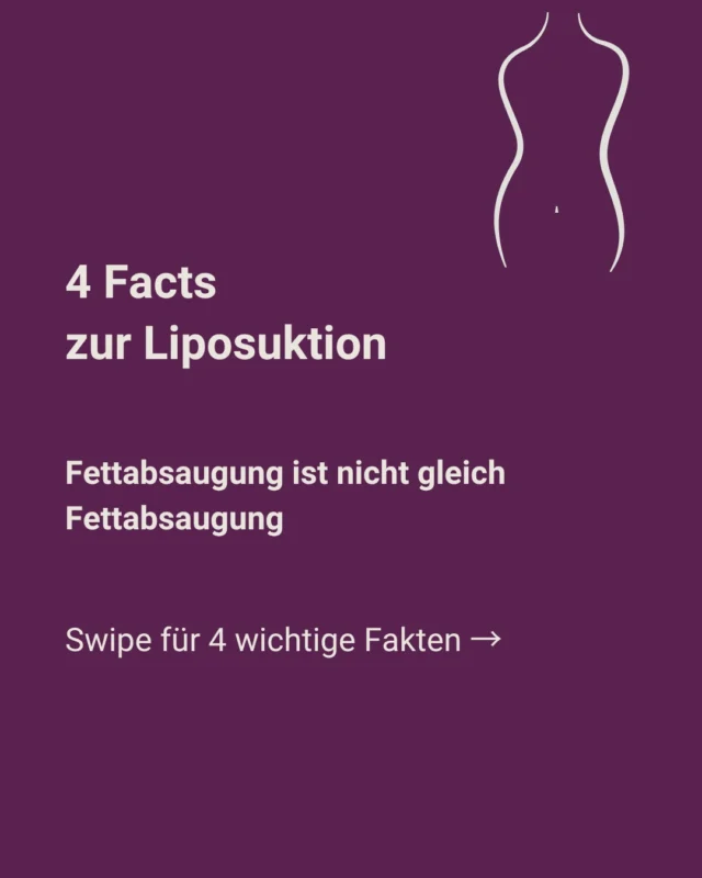 Fettabsaugung ist nicht gleich Fettabsaugung. 👀

Welche Technik bei einer Liposuktion zum Einsatz kommt, hängt unter anderem vom Behandlungsareal, der Beschaffenheit des Fettgewebes und dem gewünschten Ergebnis ab.

01 | Es gibt verschiedene Methoden

Bei der Liposuktion stehen unterschiedliche Verfahren zur Verfügung. Dazu gehören beispielsweise die klassische Aspirationslipektomie in Tumeszenztechnik, die wasserstrahl-assistierte Liposuktion (WAL) und die MicroAire Vibrations-Liposuktion (PAL).

Bei der klassischen Tumeszenztechnik wird zunächst eine spezielle Lösung in das Unterhautfettgewebe eingebracht. Anschließend wird das gelöste Fett mit feinen Kanülen abgesaugt.

02 | Liposuktion kann mehr als Volumen reduzieren

Bei der High Definition Liposuction (HDL) steht die gezielte Konturierung des Körpers im Vordergrund.

Dabei geht es nicht nur darum, Fett zu entfernen, sondern vorhandene Körperkonturen gezielt herauszuarbeiten – beispielsweise an Bauch, Flanken, Rücken oder Brustkorb.

03 | Das Gewebe spielt eine wichtige Rolle

Nicht jedes Fettgewebe ist gleich.

Bei der WAL wird ein pulsierender Wasserstrahl eingesetzt, um das Fettgewebe aus dem umliegenden Gewebe zu lösen. Die Methode kann sich unter anderem für sensible Areale eignen.

Bei der PAL unterstützt eine oszillierende Kanüle die mechanische Lösung des Fettgewebes und kann insbesondere bei festerem, fibrösem Gewebe eingesetzt werden.

04 | Eine Liposuktion ist nicht immer die passende Methode

Auch das ist wichtig: Nicht jedes Fettdepot sollte automatisch abgesaugt werden.

Bei kleineren, lokal begrenzten Fettdepots können je nach Befund auch andere Verfahren infrage kommen. Besteht zusätzlich ein ausgeprägter Hautüberschuss, kann dagegen ein anderer operativer Eingriff wie eine Bauchdeckenstraffung sinnvoller sein.

👉 Welche Methode geeignet ist, lässt sich deshalb nicht pauschal beantworten. Entscheidend sind der individuelle Befund, die Anatomie und das gewünschte Behandlungsziel.

Welcher der vier Facts war für dich neu? 👇

#schlossparkklinik #ludwigsburg #liposuktion #medizinwissen